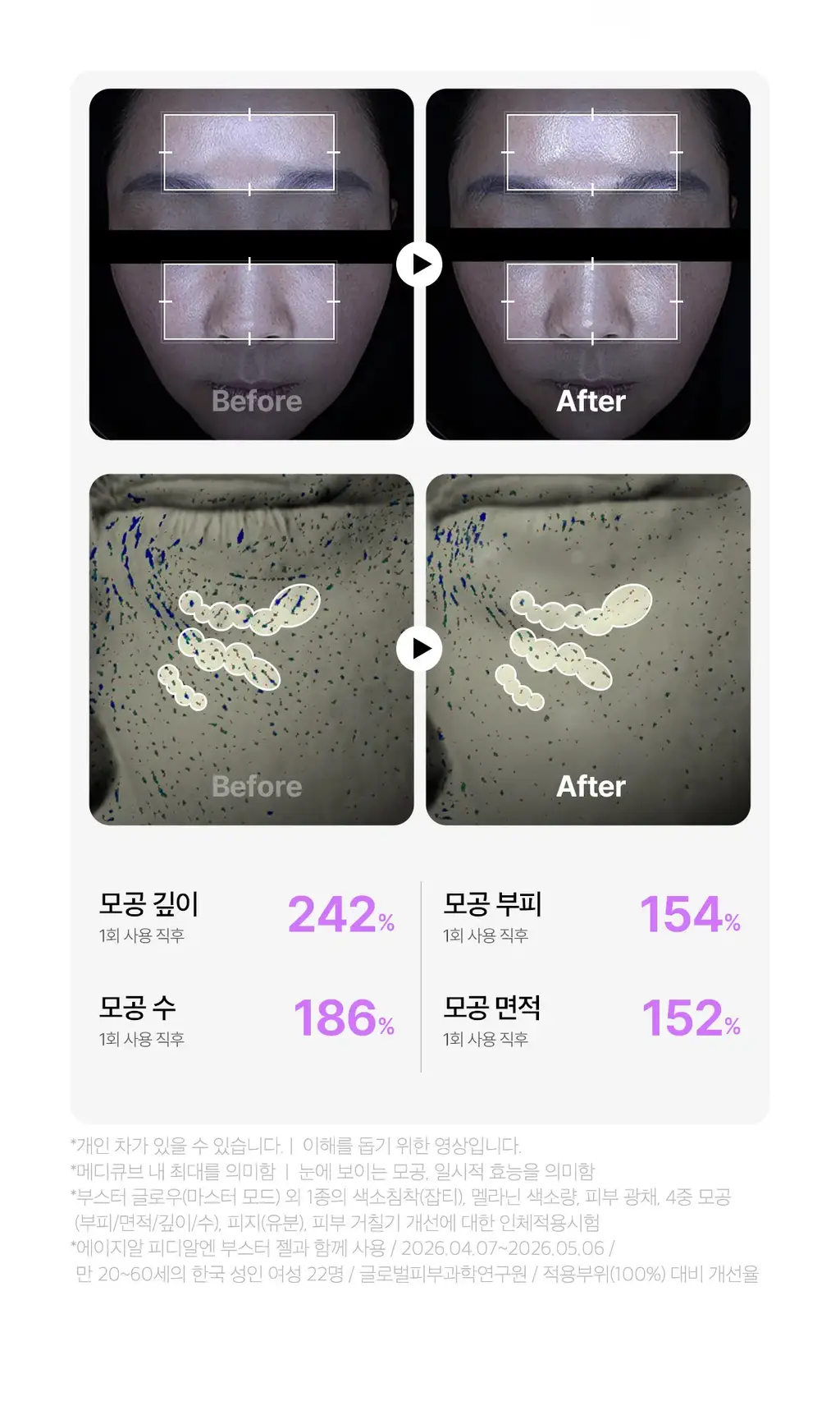 [5월올영픽] [물방울초음파] 메디큐브 에이지알 부스터 글로우 (로즈핑크/그레이) 상세페이지 38